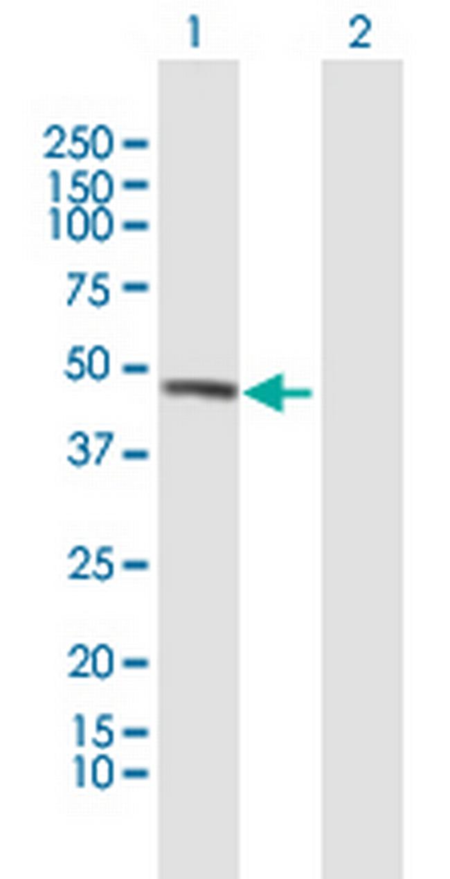 UBAC1 Antibody in Western Blot (WB)