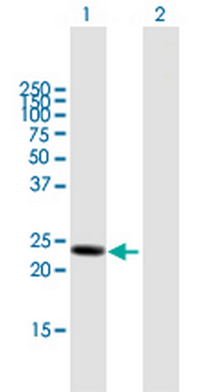 LYPLA1 Antibody in Western Blot (WB)