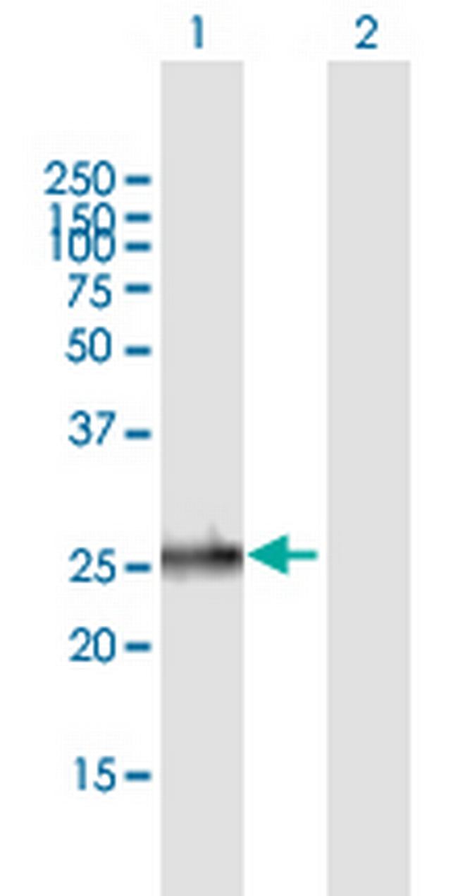 EMG1 Antibody in Western Blot (WB)