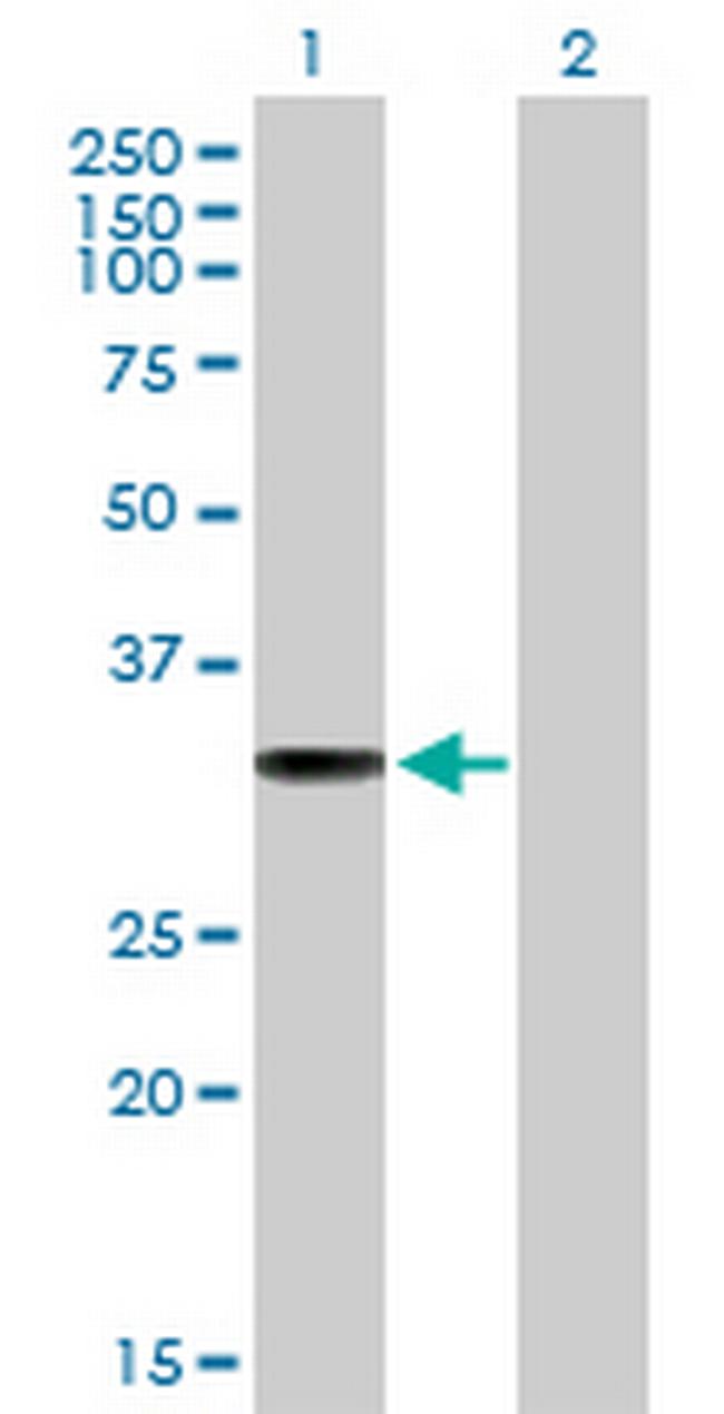 IFI30 Antibody in Western Blot (WB)