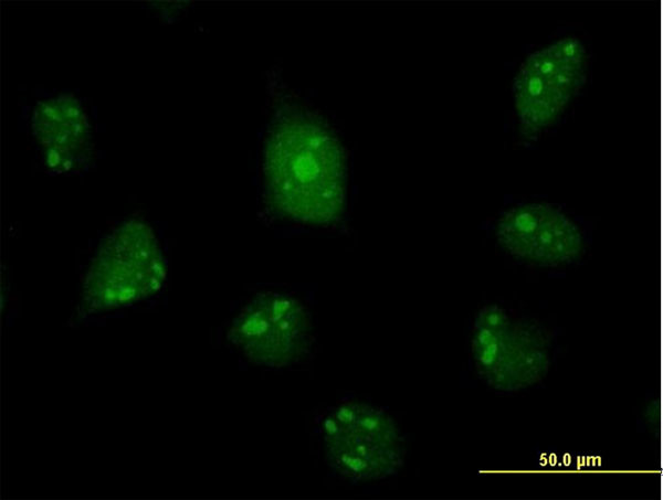 C1D Antibody in Immunocytochemistry (ICC/IF)