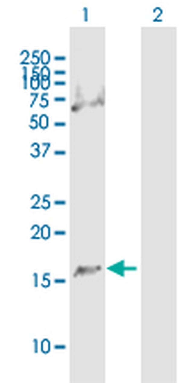 C1D Antibody in Western Blot (WB)