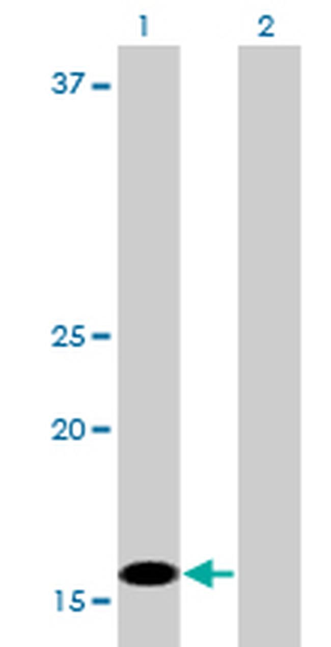 C1D Antibody in Western Blot (WB)