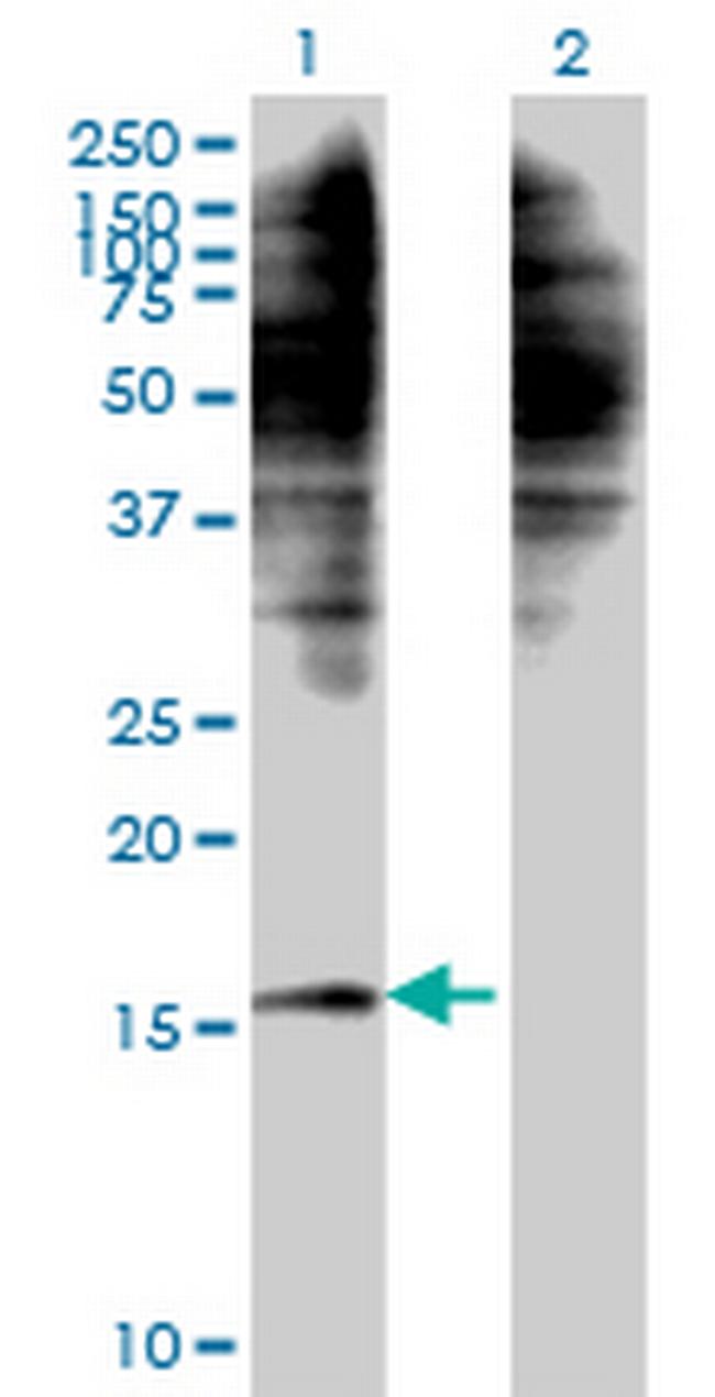 C1D Antibody in Western Blot (WB)