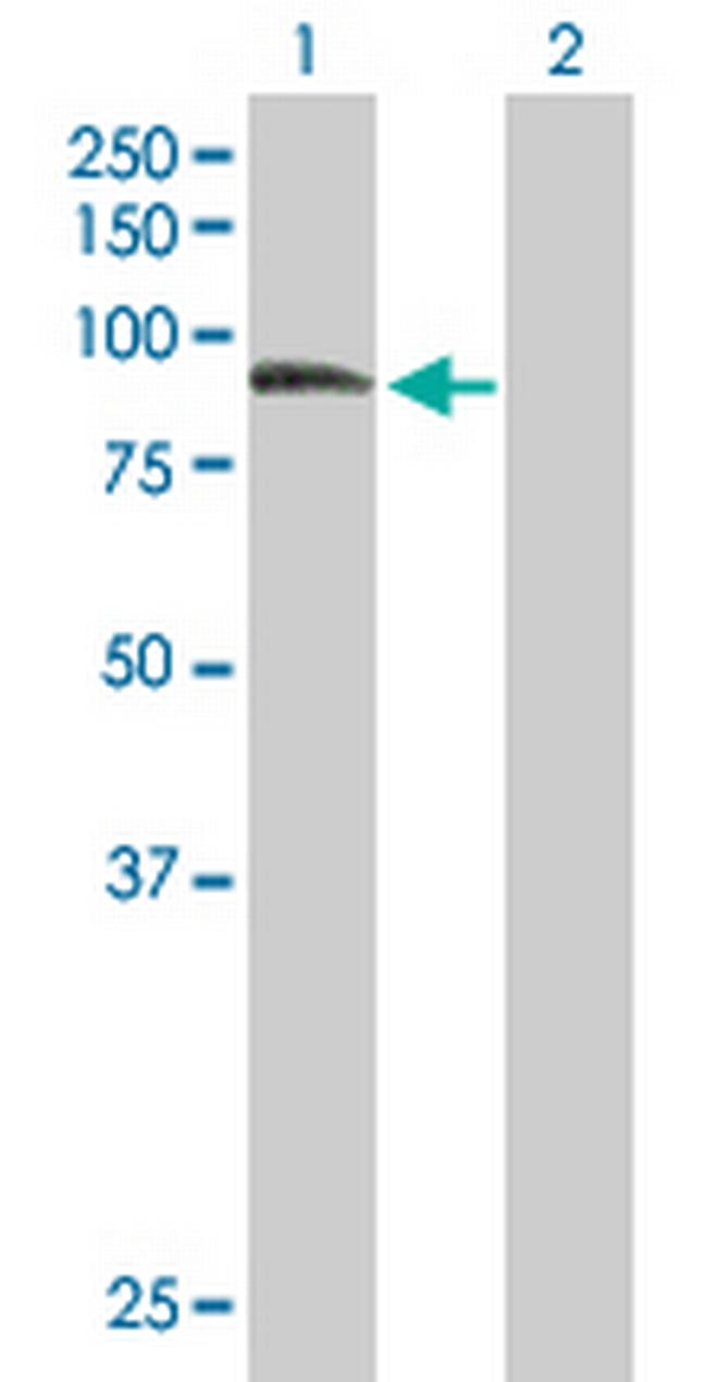 ZER1 Antibody in Western Blot (WB)