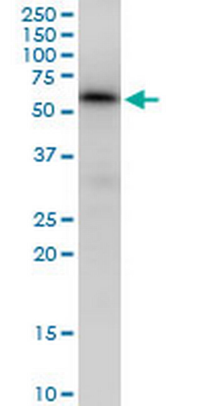 MAP3K7IP1 Antibody in Western Blot (WB)