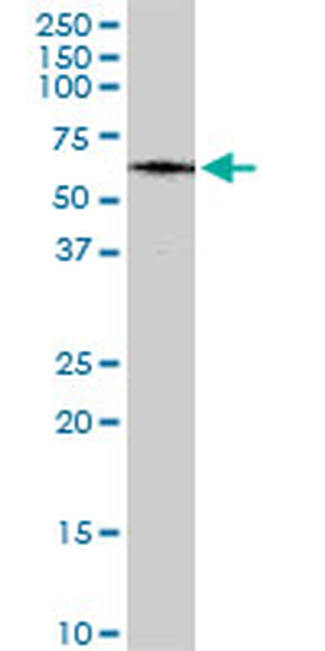 MAP3K7IP1 Antibody in Western Blot (WB)