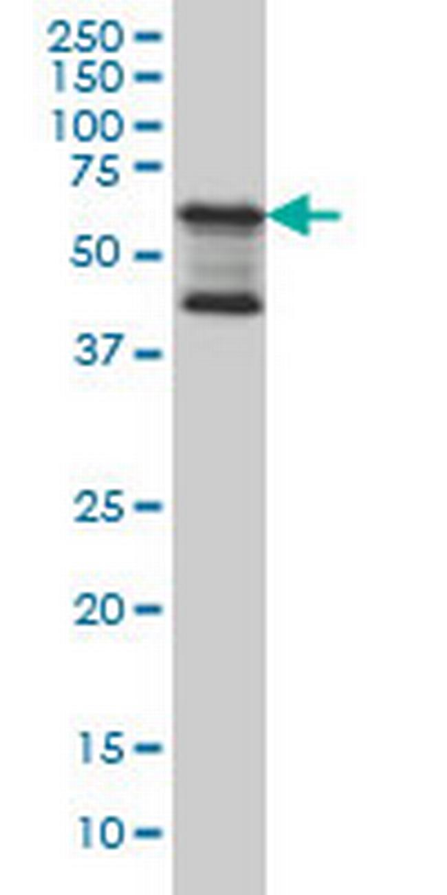 MAP3K7IP1 Antibody in Western Blot (WB)