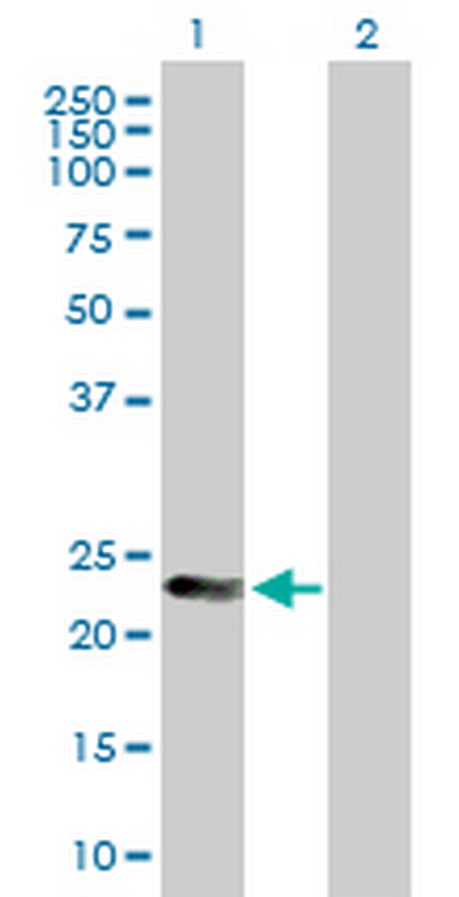 MAD2L2 Antibody in Western Blot (WB)