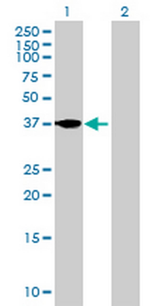 FST Antibody in Western Blot (WB)