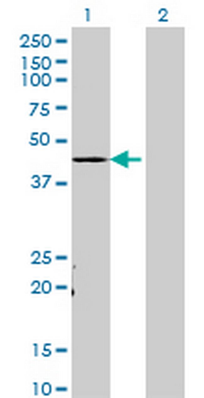 TADA3L Antibody in Western Blot (WB)