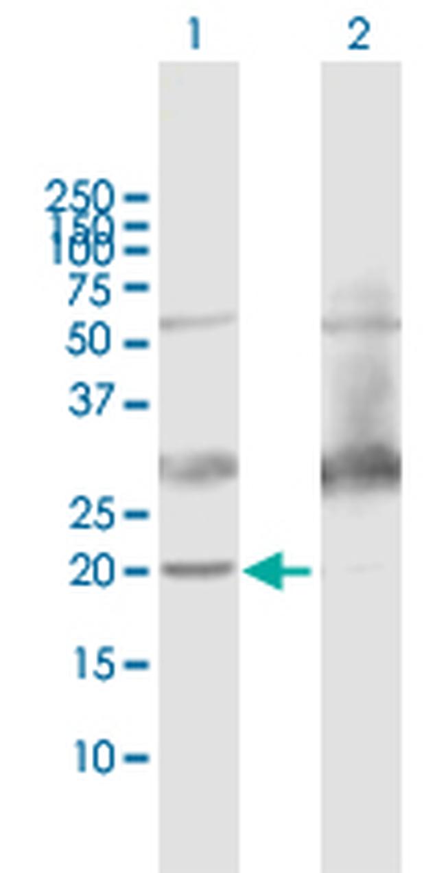 ATP5H Antibody in Western Blot (WB)