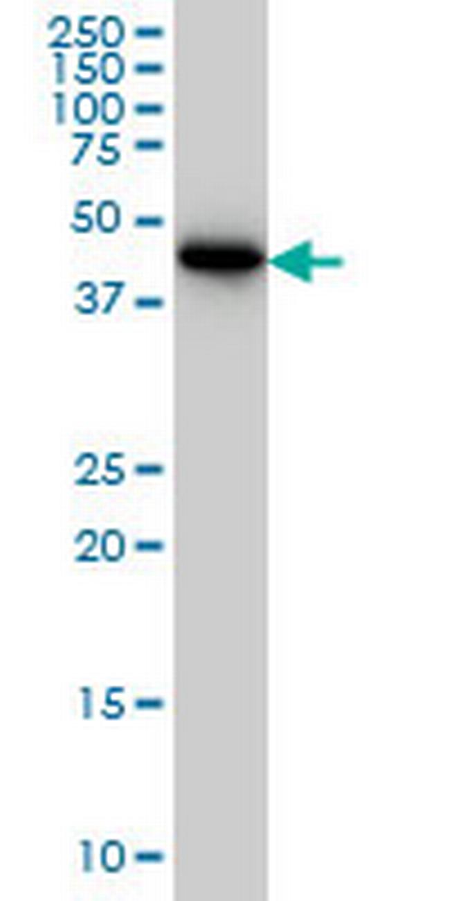 CRTAP Antibody in Western Blot (WB)