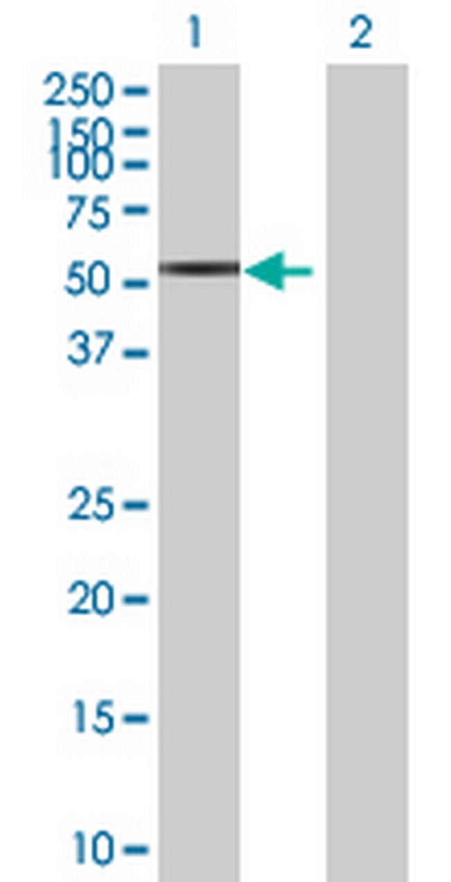 STK25 Antibody in Western Blot (WB)