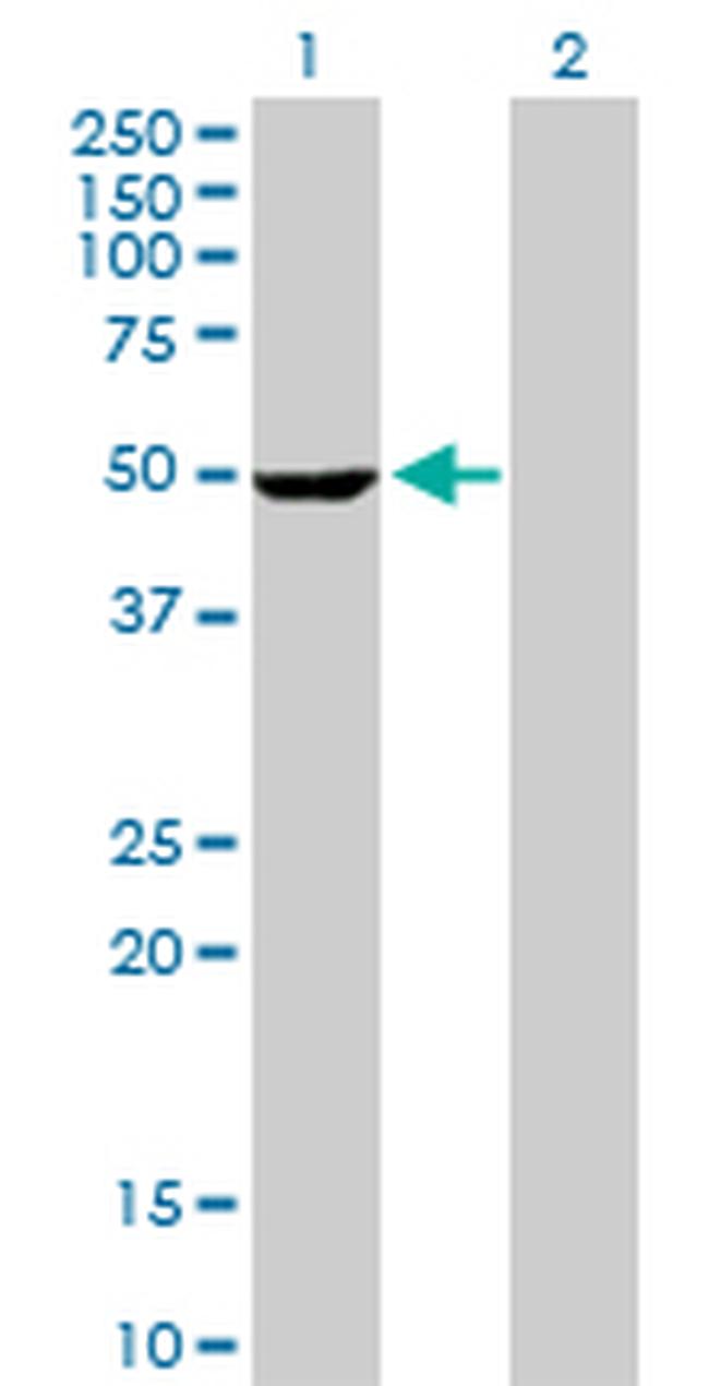 STK25 Antibody in Western Blot (WB)