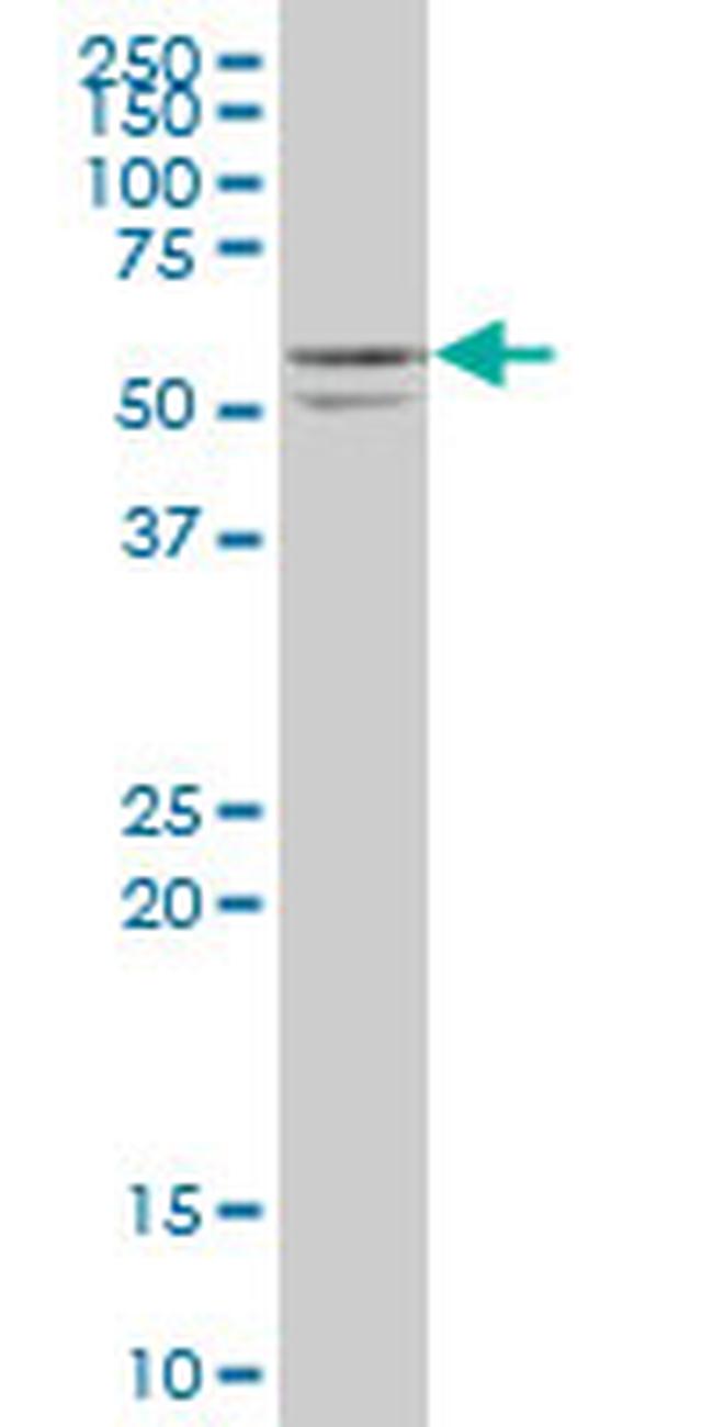 STK25 Antibody in Western Blot (WB)