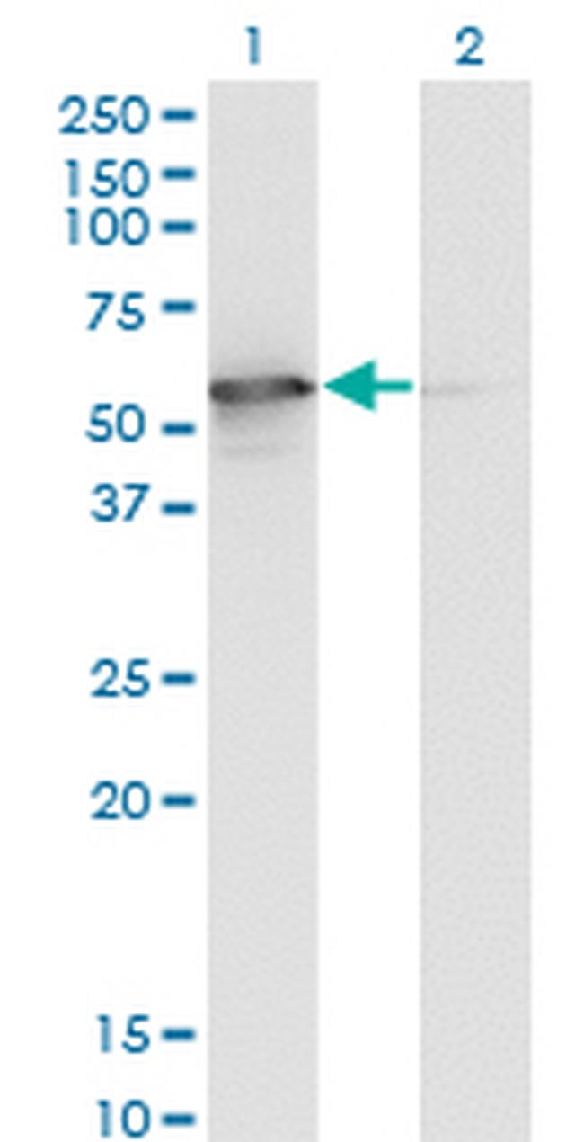 STK25 Antibody in Western Blot (WB)