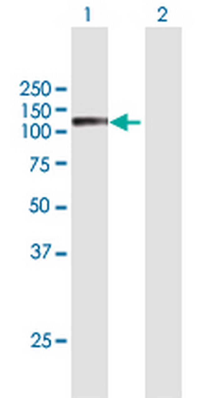 SEMA6C Antibody in Western Blot (WB)