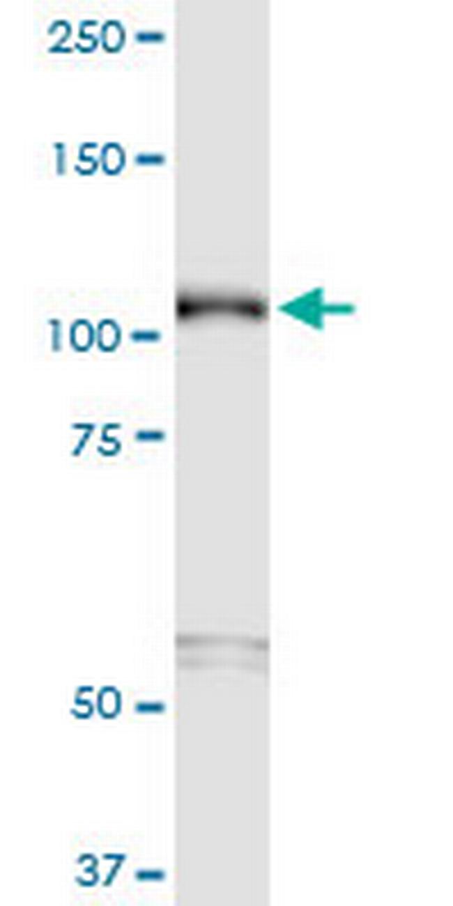 SEMA6B Antibody in Western Blot (WB)