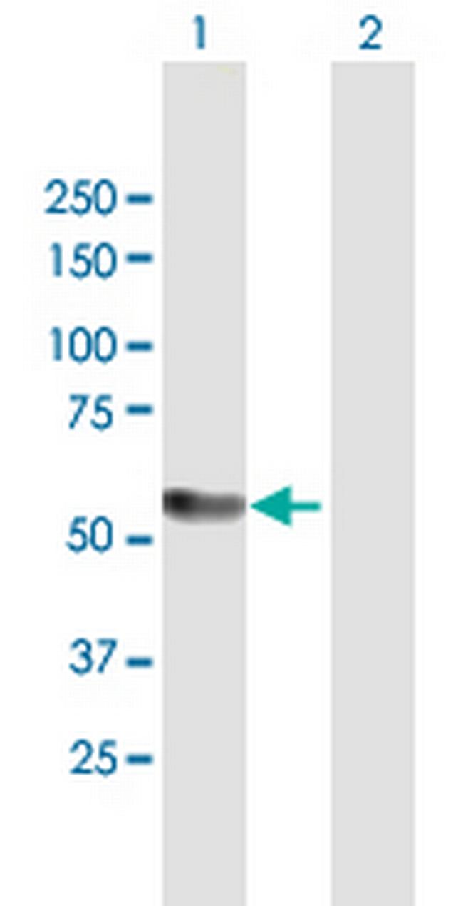 KAT5 Antibody in Western Blot (WB)