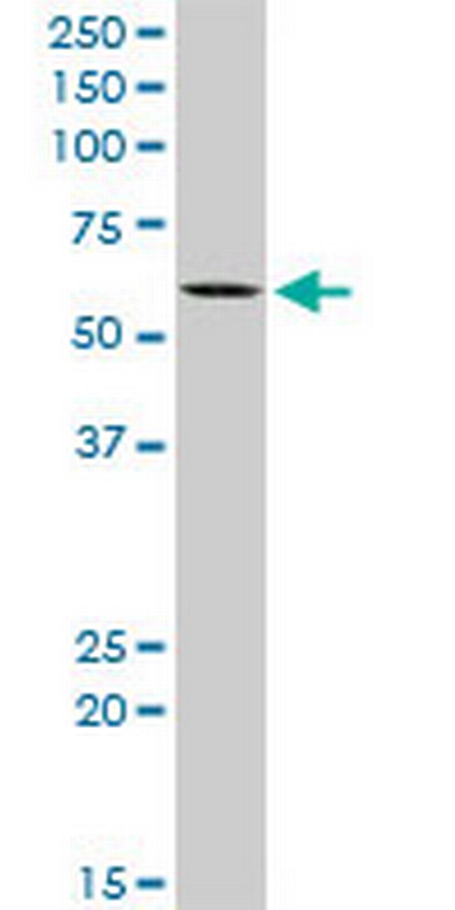 KAT5 Antibody in Western Blot (WB)