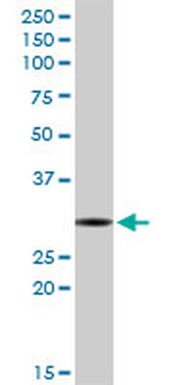 RNASEH2A Antibody in Western Blot (WB)