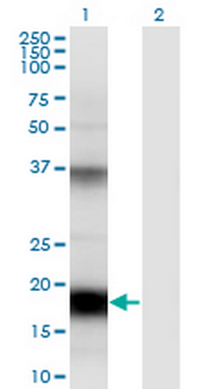 UBD Antibody in Western Blot (WB)