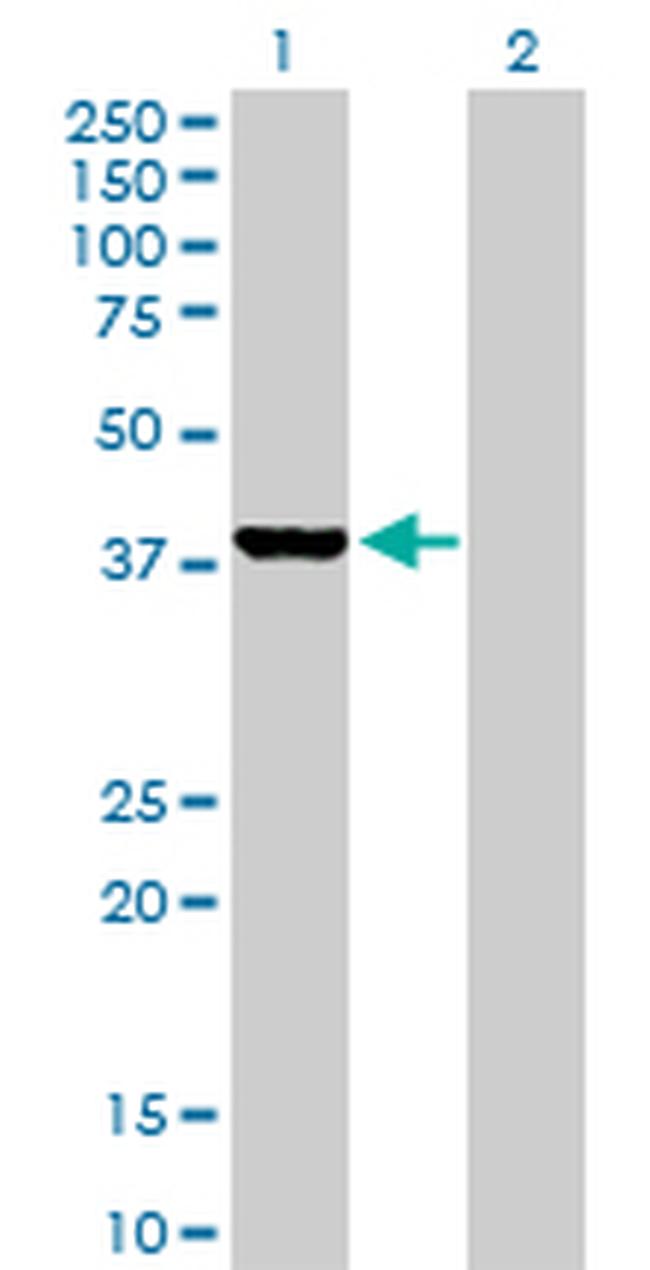 GLRX3 Antibody in Western Blot (WB)