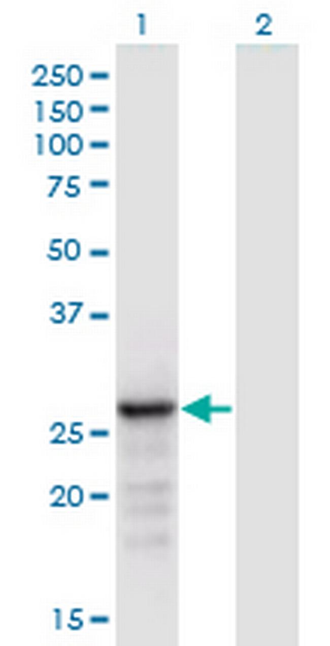 ANP32B Antibody in Western Blot (WB)