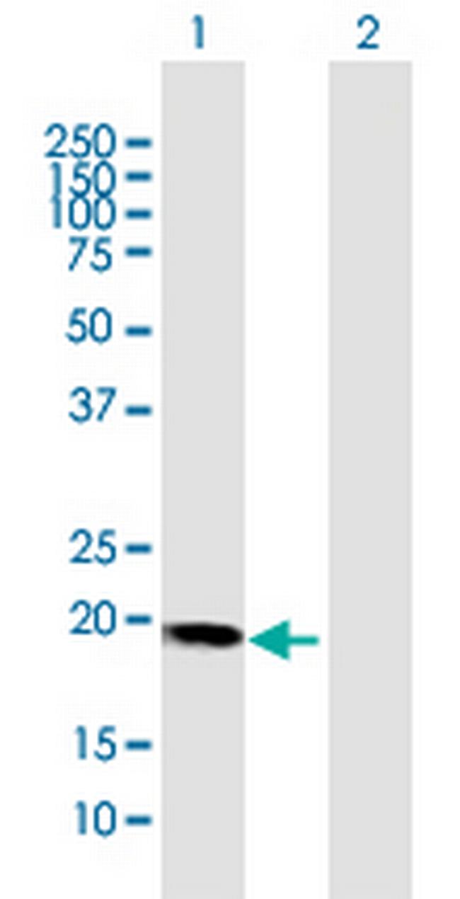 HBXIP Antibody in Western Blot (WB)