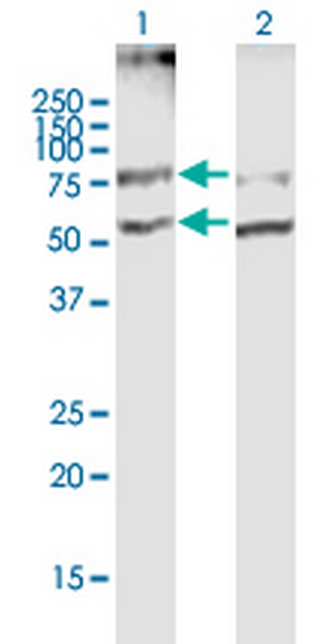SLC19A2 Antibody in Western Blot (WB)