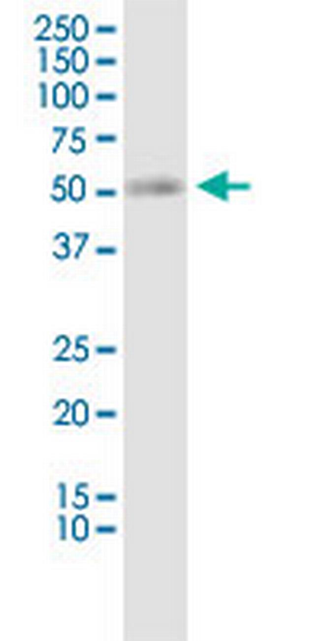 SLC19A2 Antibody in Western Blot (WB)