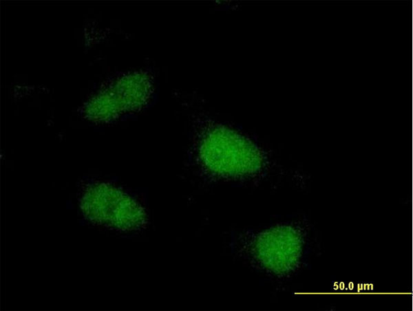 SIVA Antibody in Immunocytochemistry (ICC/IF)