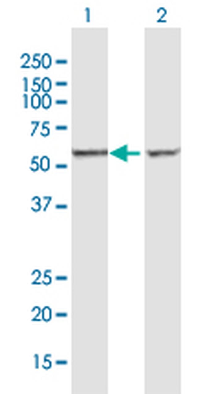 CCT7 Antibody in Western Blot (WB)