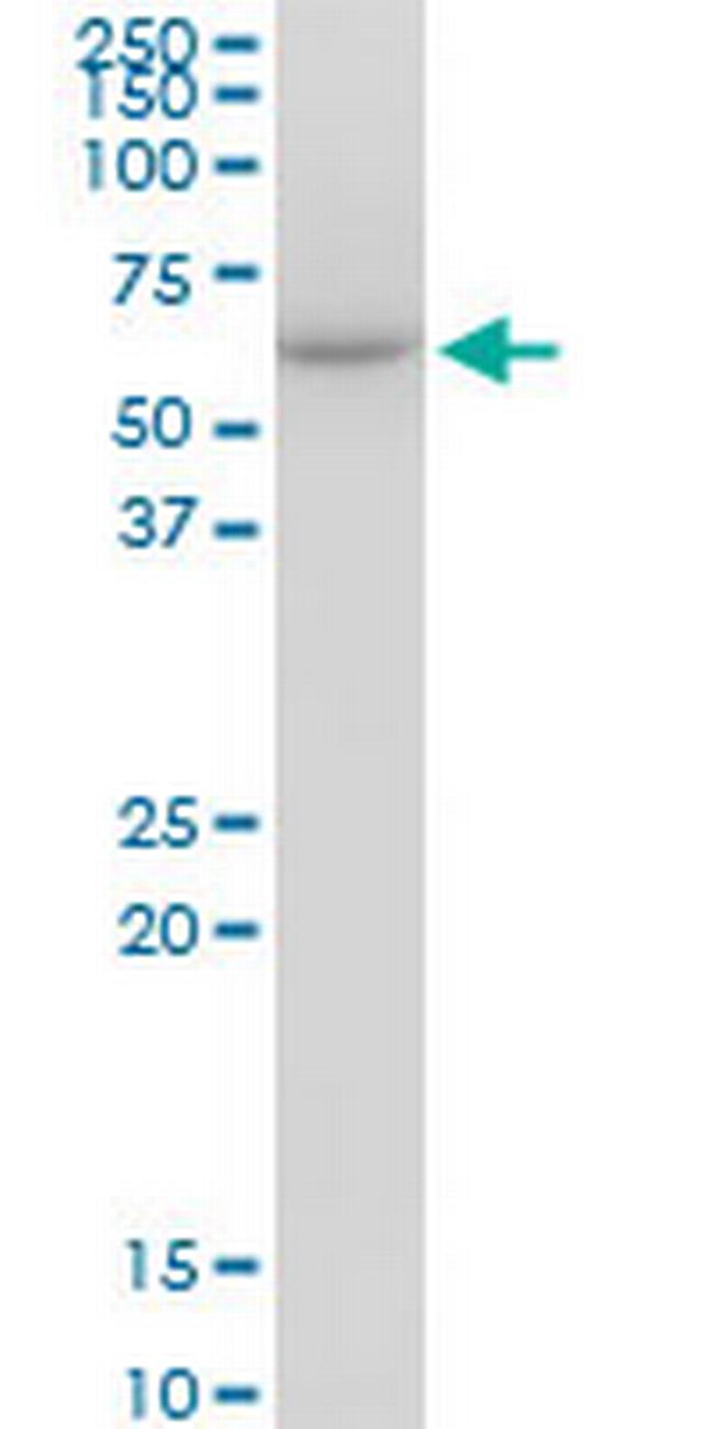 CCT7 Antibody in Western Blot (WB)