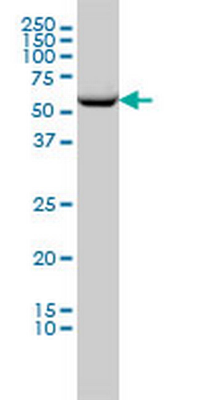 CCT2 Antibody in Western Blot (WB)