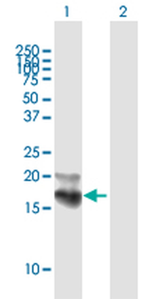 NPC2 Antibody in Western Blot (WB)