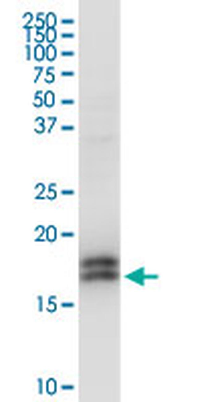 NPC2 Antibody in Western Blot (WB)