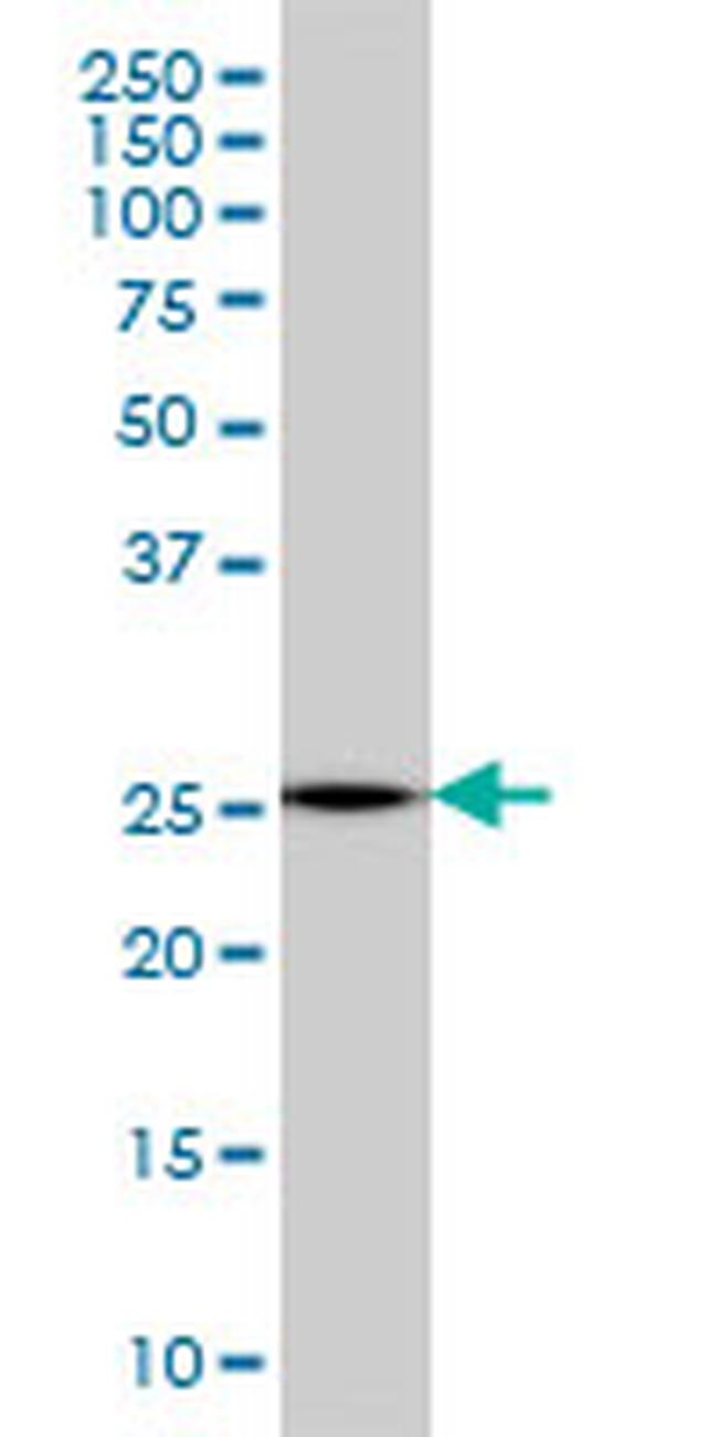 MTHFS Antibody in Western Blot (WB)