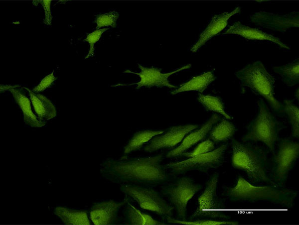 SCGN Antibody in Immunocytochemistry (ICC/IF)