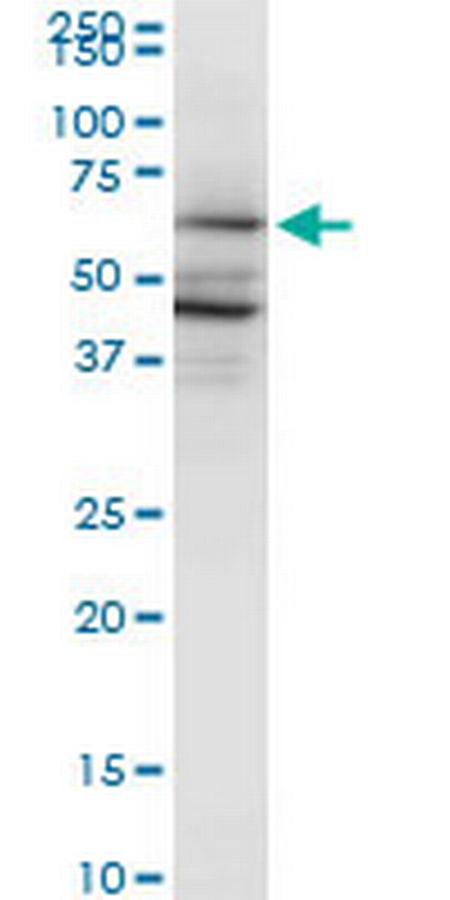 PAIP1 Antibody in Western Blot (WB)