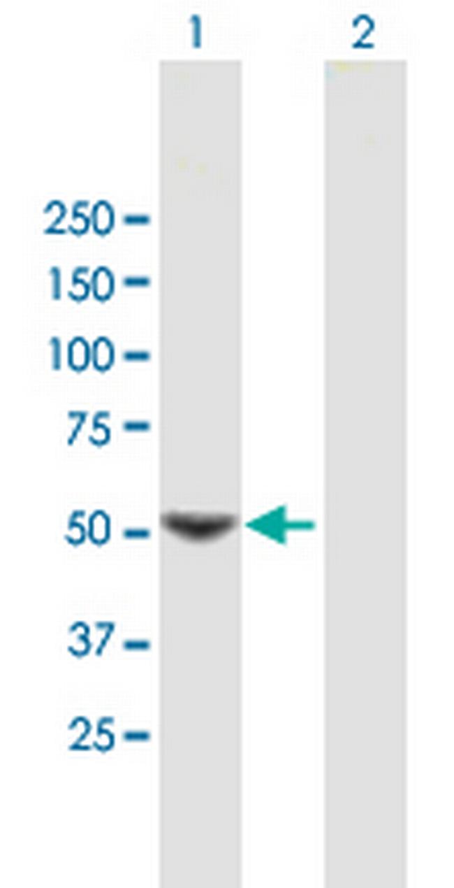 SC65 Antibody in Western Blot (WB)