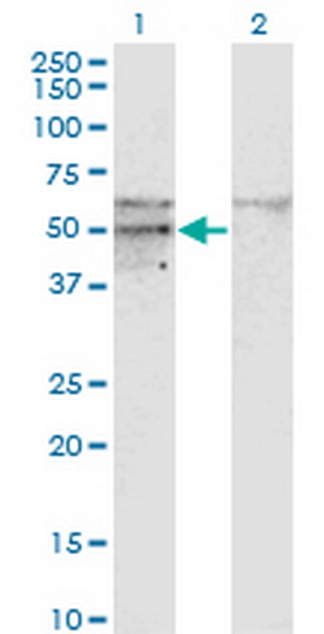 SC65 Antibody in Western Blot (WB)