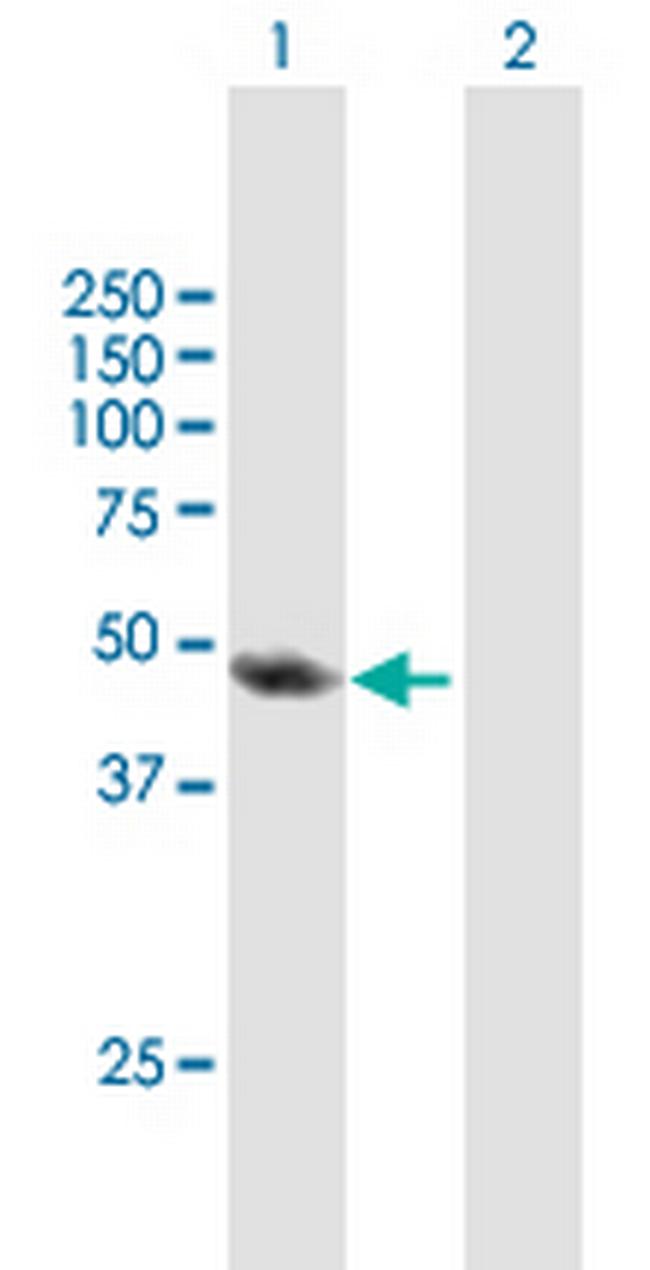 TAF6L Antibody in Western Blot (WB)
