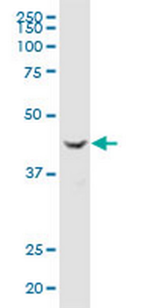 TUSC4 Antibody in Western Blot (WB)