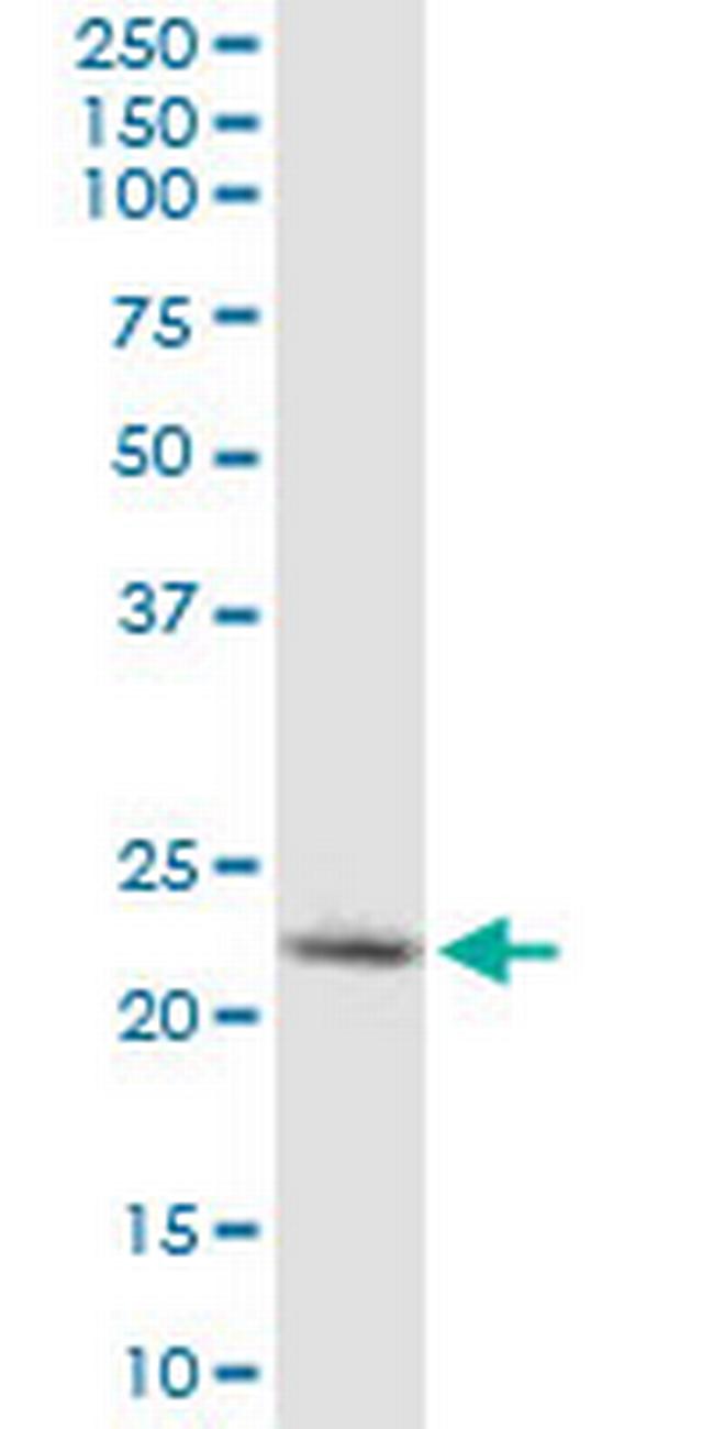 YKT6 Antibody in Western Blot (WB)