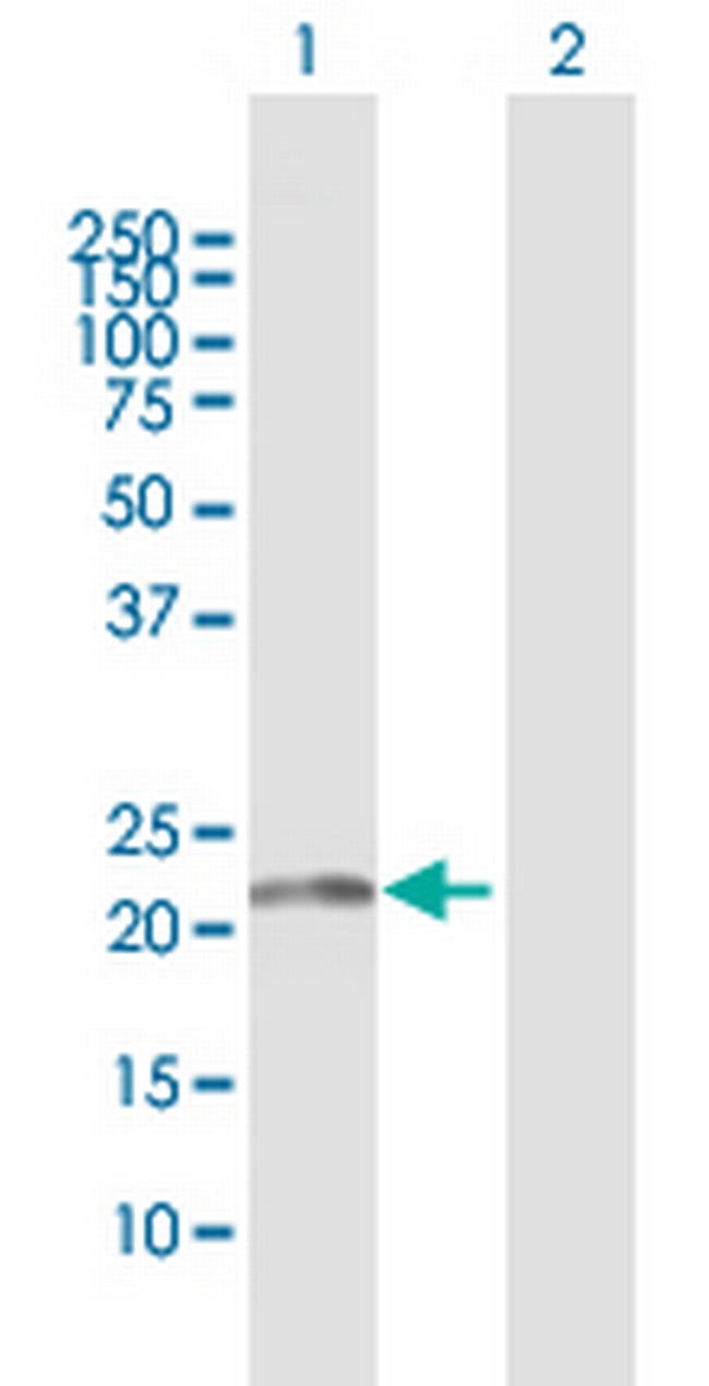 PMVK Antibody in Western Blot (WB)