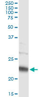 PMVK Antibody in Immunoprecipitation (IP)