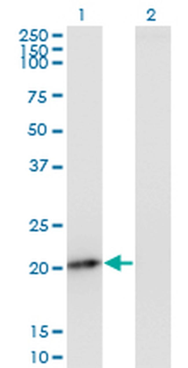 PMVK Antibody in Western Blot (WB)