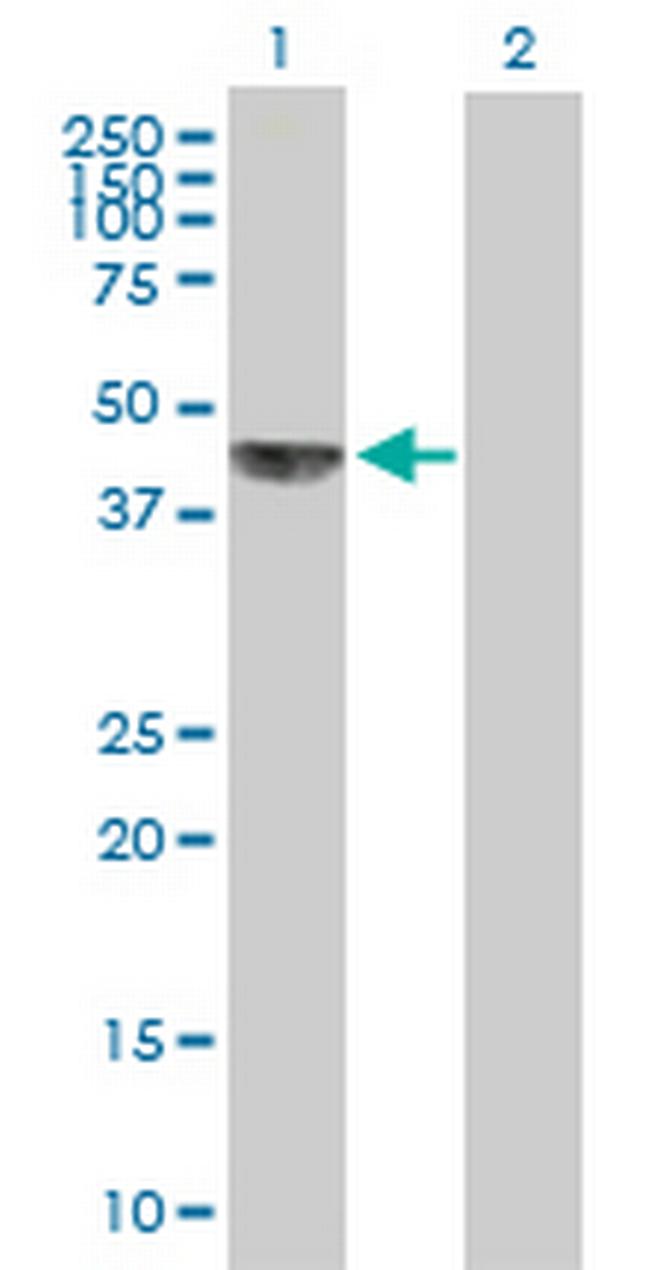 KHDRBS1 Antibody in Western Blot (WB)